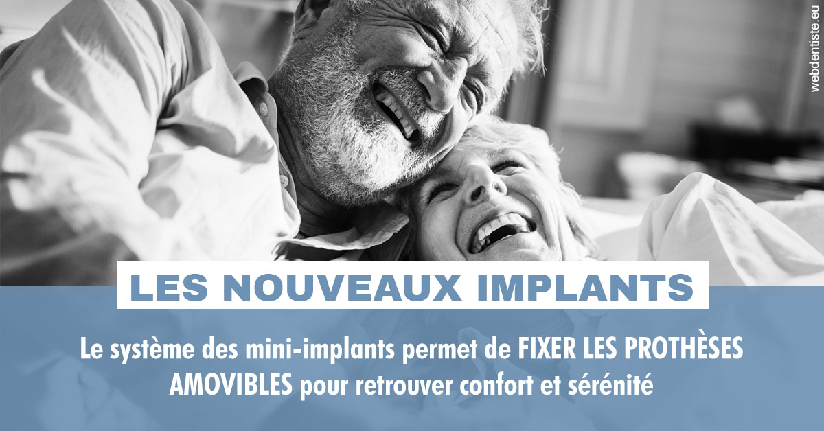 https://selarl-dr-gombauld.chirurgiens-dentistes.fr/Les nouveaux implants 2
