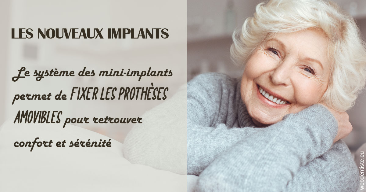 https://selarl-dr-gombauld.chirurgiens-dentistes.fr/Les nouveaux implants 1