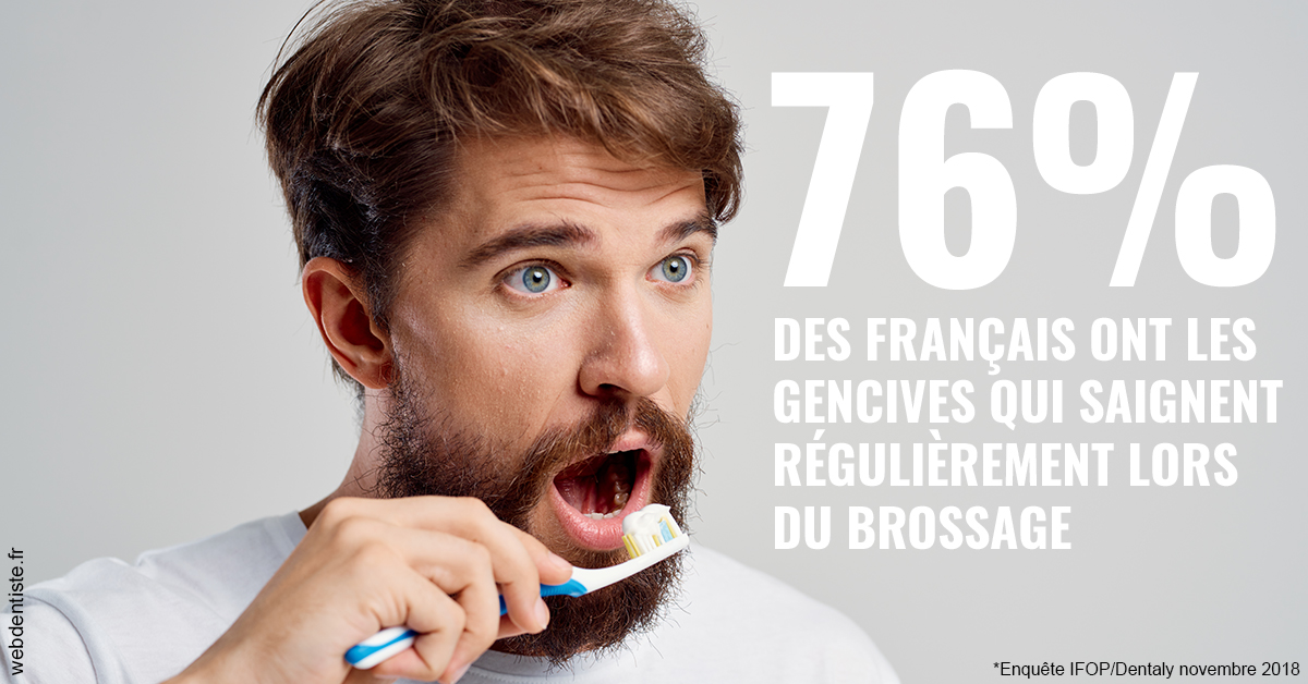https://selarl-dr-gombauld.chirurgiens-dentistes.fr/76% des Français 2