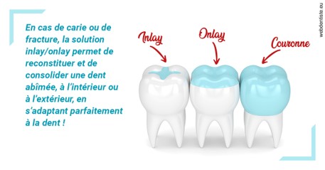 https://selarl-dr-gombauld.chirurgiens-dentistes.fr/L'INLAY ou l'ONLAY