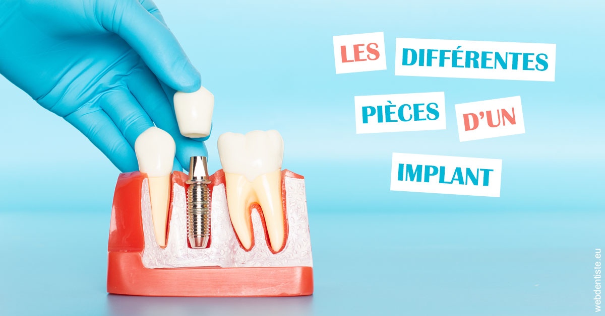 https://selarl-dr-gombauld.chirurgiens-dentistes.fr/Les différentes pièces d’un implant 2