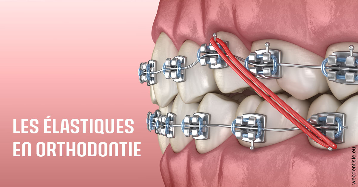 https://selarl-dr-gombauld.chirurgiens-dentistes.fr/Elastiques orthodontie 2