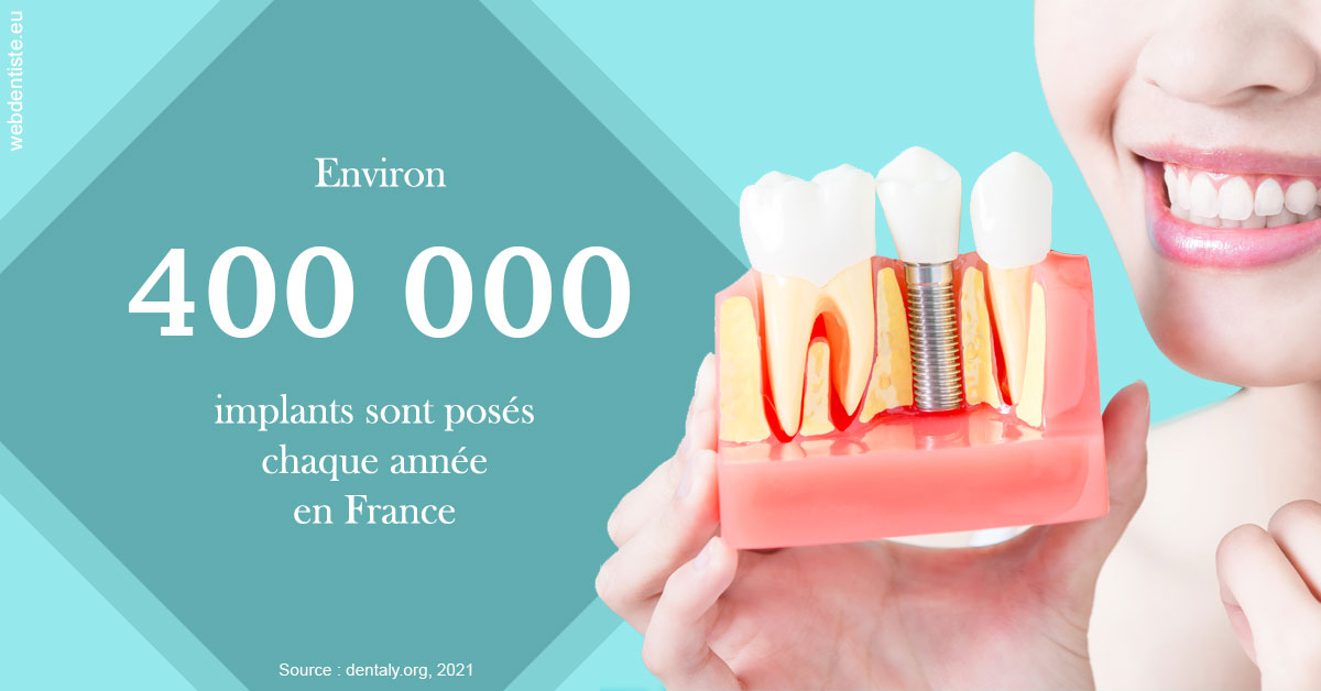 https://selarl-dr-gombauld.chirurgiens-dentistes.fr/Pose d'implants en France 2